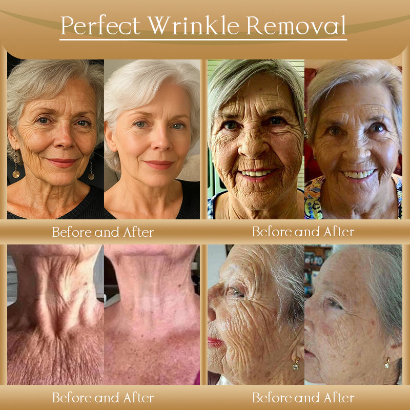 Jorondy® Anti-Wrinkle Skin Cream for Remove Wrinkles, Firms Skin, Whitening - Last Day Sale🔥90% OFF