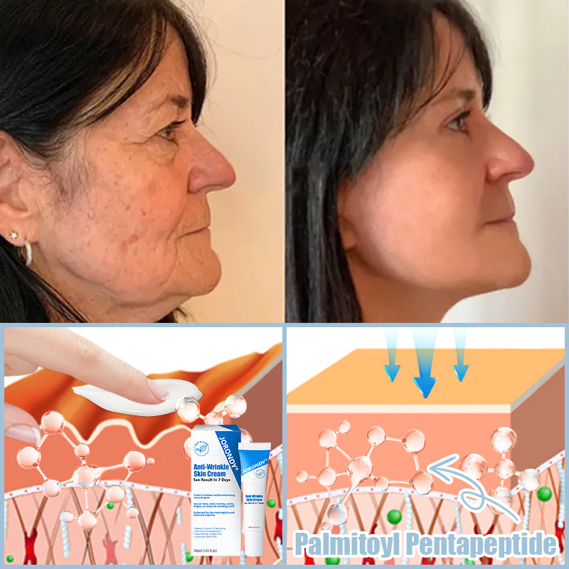 Jorondy® Anti-Wrinkle Skin Cream for Remove Wrinkles, Firms Skin, Whitening - Last Day Sale🔥90% OFF