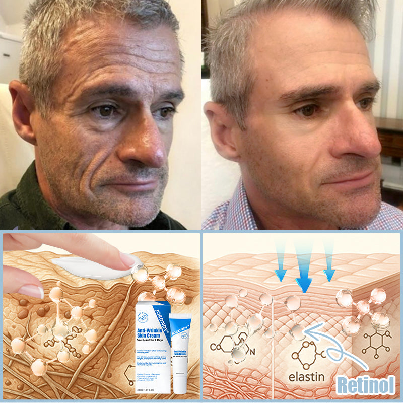 Jorondy® Anti-Wrinkle Skin Cream for Remove Wrinkles, Firms Skin, Whitening - Last Day Sale🔥90% OFF