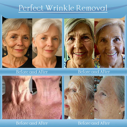 Jorondy® Anti-Wrinkle Skin Cream for Remove Wrinkles, Firms Skin, Whitening - Last Day Sale🔥90% OFF
