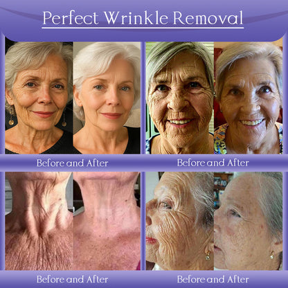 Jorondy® Anti-Wrinkle Skin Cream for Remove Wrinkles, Firms Skin, Whitening - Last Day Sale🔥90% OFF🔥