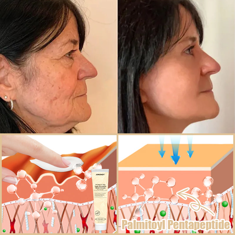 Jorondy® Anti-Wrinkle Skin Cream for Remove Wrinkles, Firms Skin, Whitening - Last Day Sale🔥90% OFF