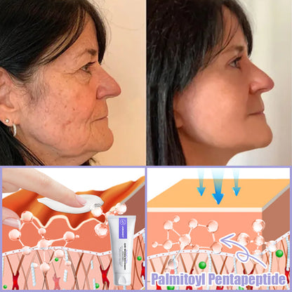 Jorondy® Anti-Wrinkle Skin Cream for Remove Wrinkles, Firms Skin, Whitening - Last Day Sale🔥90% OFF🔥