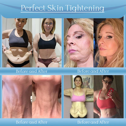 Jorondy® Anti-Wrinkle Skin Cream for Remove Wrinkles, Firms Skin, Whitening - Last Day Sale🔥90% OFF