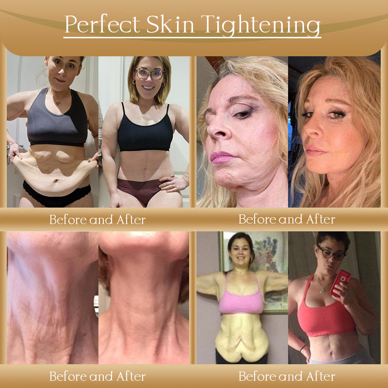 Jorondy® Anti-Wrinkle Skin Cream for Remove Wrinkles, Firms Skin, Whitening - Last Day Sale🔥90% OFF
