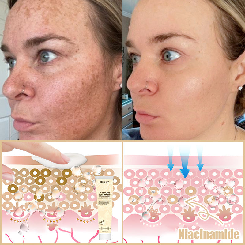 Jorondy® Anti-Wrinkle Skin Cream for Remove Wrinkles, Firms Skin, Whitening - Last Day Sale🔥90% OFF