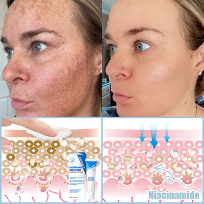 Jorondy® Anti-Wrinkle Skin Cream for Remove Wrinkles, Firms Skin, Whitening - Last Day Sale🔥90% OFF