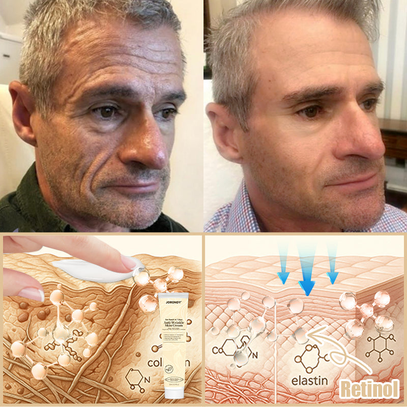 Jorondy® Anti-Wrinkle Skin Cream for Remove Wrinkles, Firms Skin, Whitening - Last Day Sale🔥90% OFF