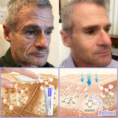 Jorondy® Anti-Wrinkle Skin Cream for Remove Wrinkles, Firms Skin, Whitening - Last Day Sale🔥90% OFF🔥